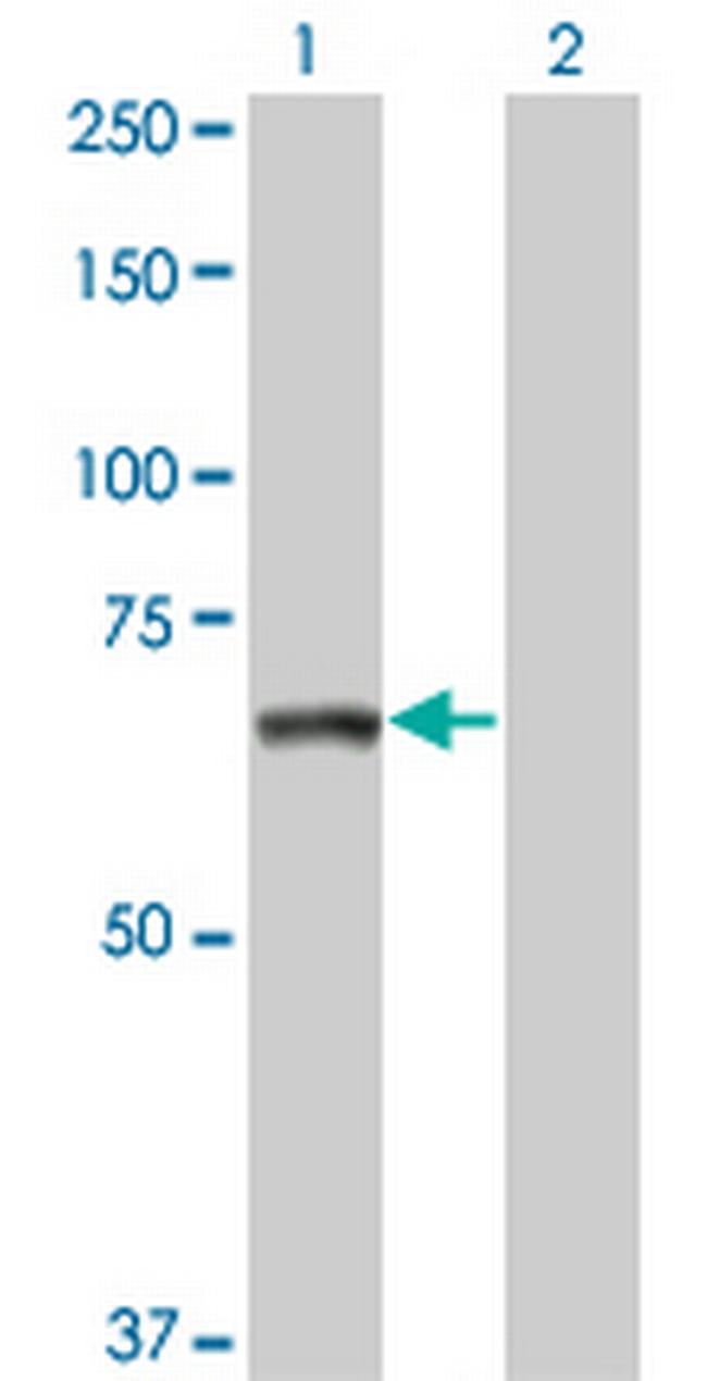 TNIK Antibody in Western Blot (WB)