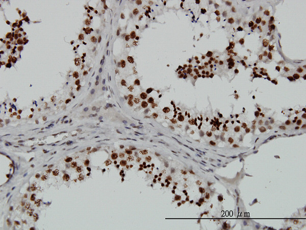 SMG1 Antibody in Immunohistochemistry (Paraffin) (IHC (P))