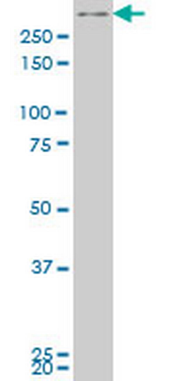 SMG1 Antibody in Western Blot (WB)
