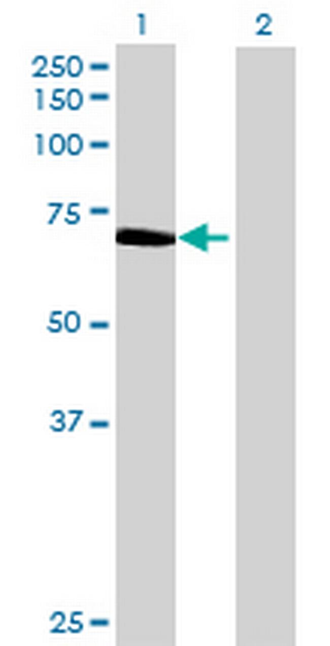 GGA2 Antibody in Western Blot (WB)