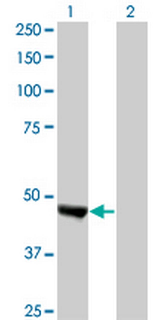 KIAA0261 Antibody in Western Blot (WB)
