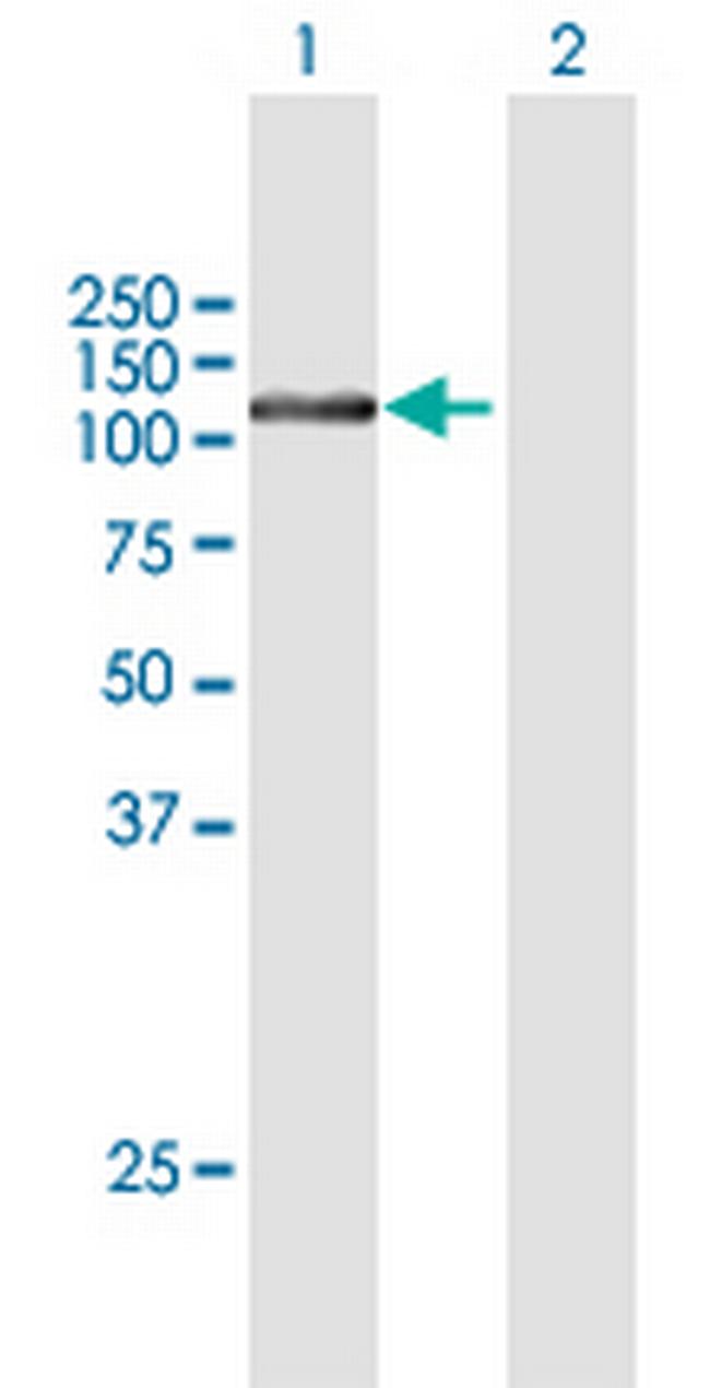 FTSJD2 Antibody in Western Blot (WB)