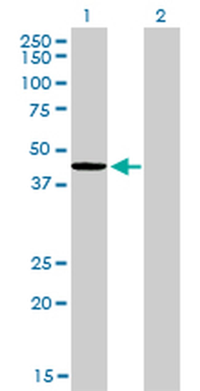 TXNDC4 Antibody in Western Blot (WB)