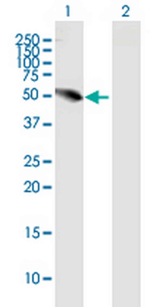 UHRF1BP1L Antibody in Western Blot (WB)