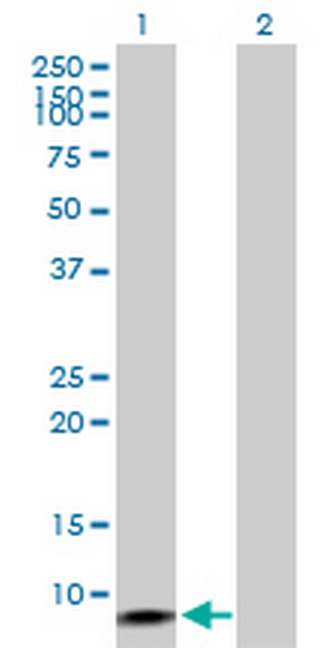 ERC1 Antibody in Western Blot (WB)