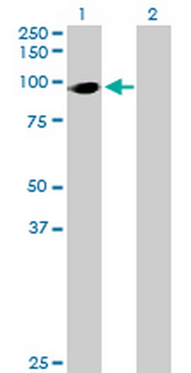 HIC2 Antibody in Western Blot (WB)