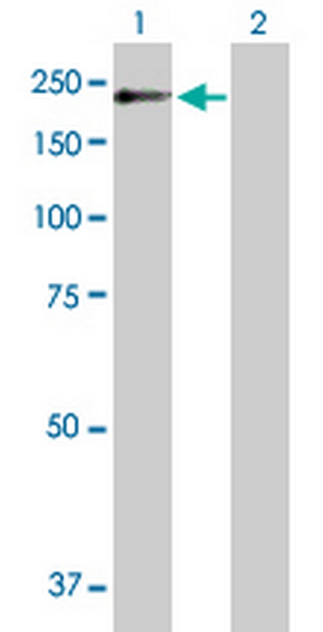 POGZ Antibody in Western Blot (WB)