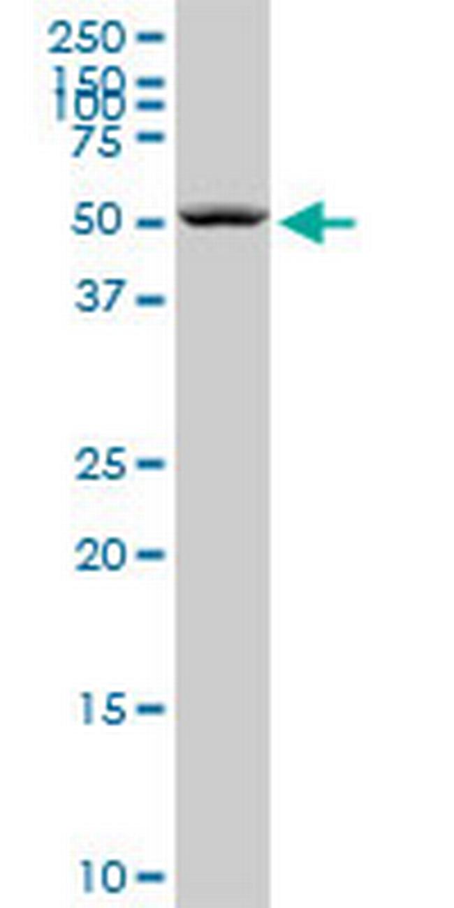 SEPT6 Antibody in Western Blot (WB)