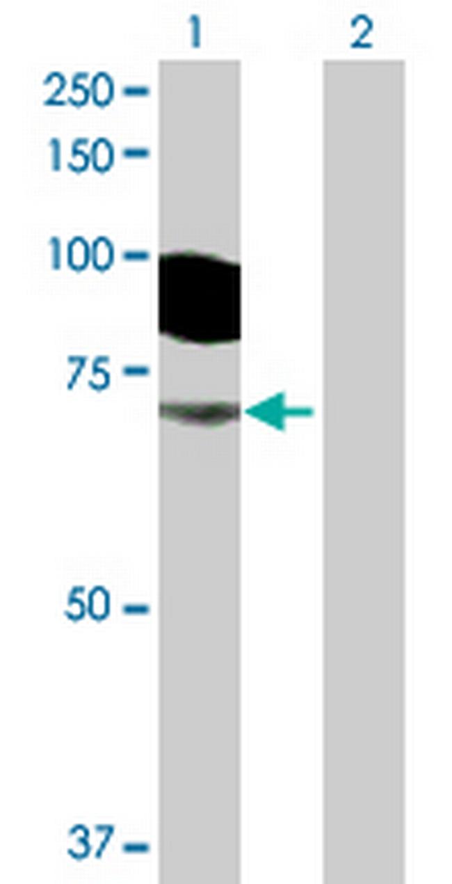 GGA3 Antibody in Western Blot (WB)
