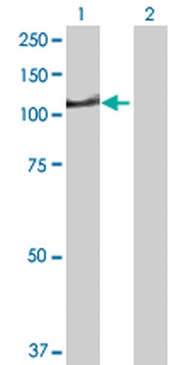 DIP2A Antibody in Western Blot (WB)