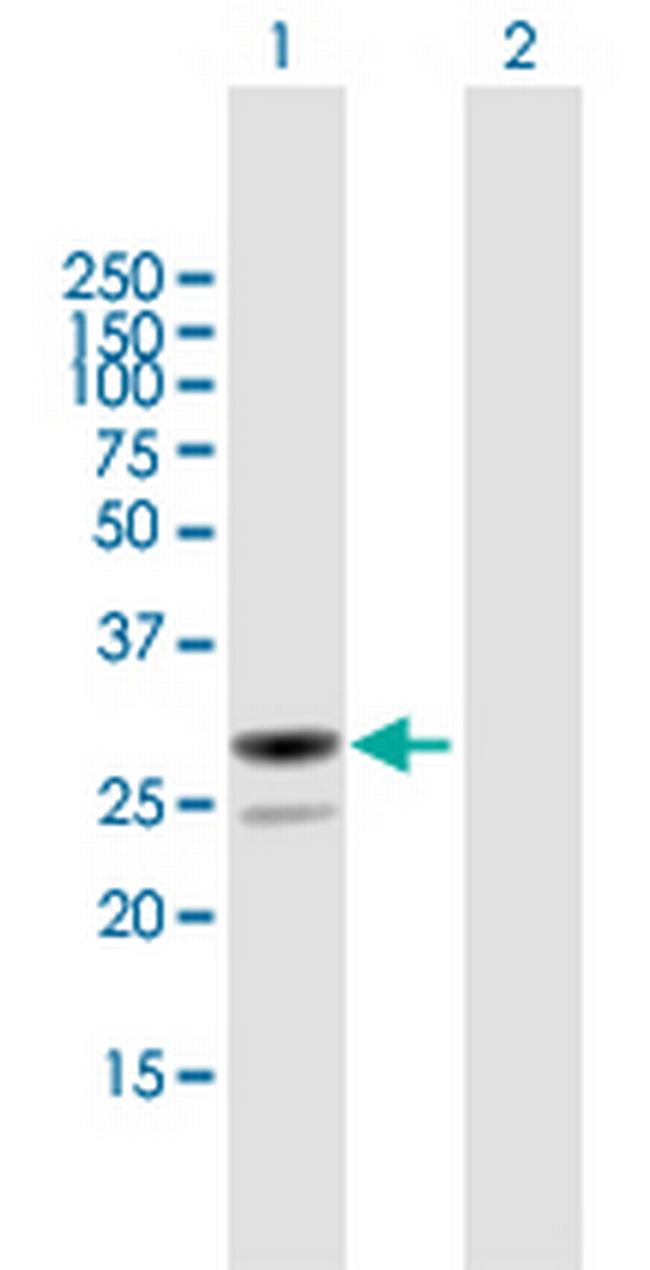MESDC2 Antibody in Western Blot (WB)