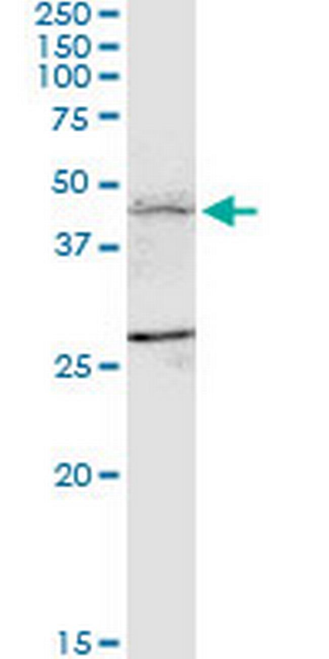 FBXL7 Antibody in Western Blot (WB)