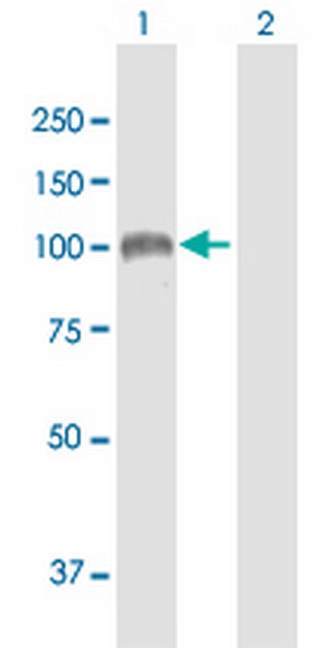 SULF1 Antibody in Western Blot (WB)
