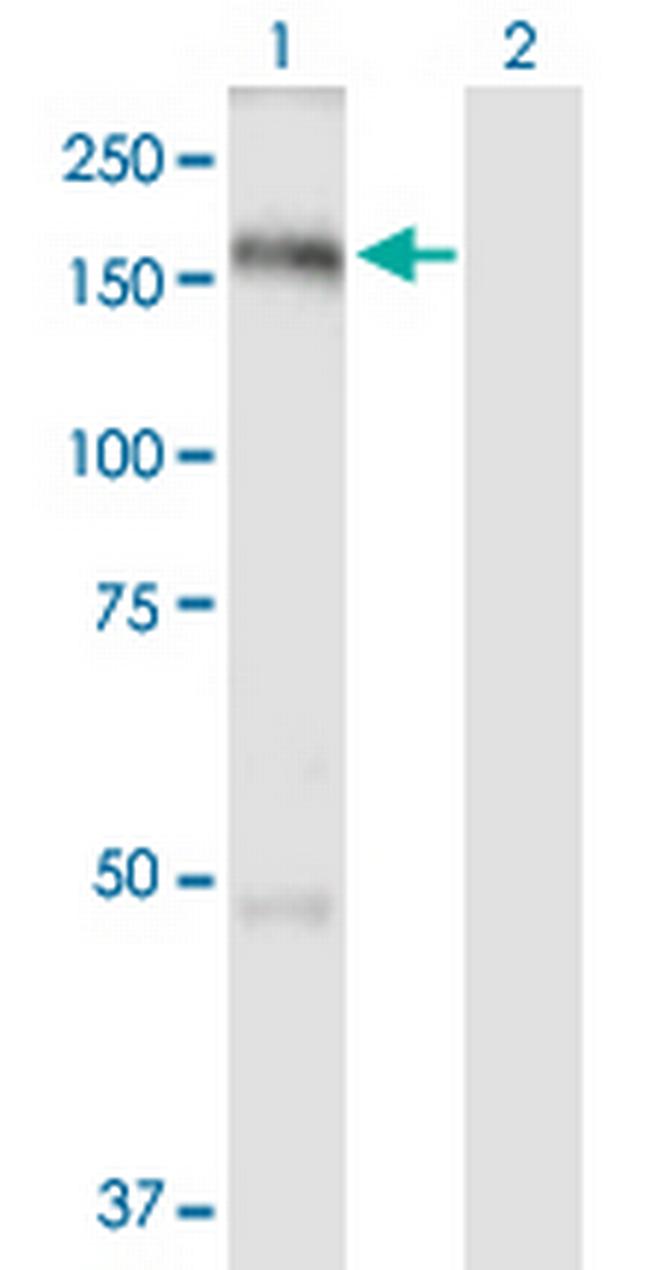 TBC1D1 Antibody in Western Blot (WB)