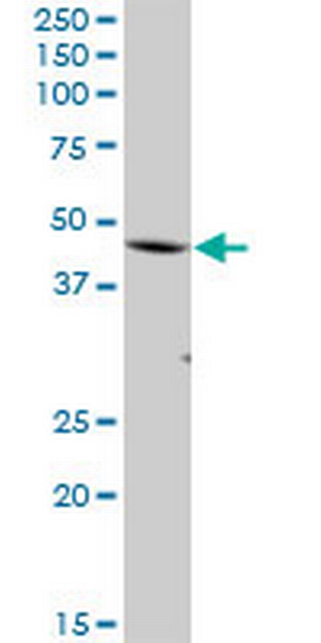 FBXO28 Antibody in Western Blot (WB)