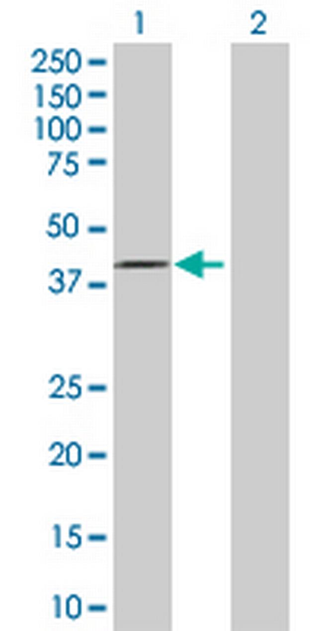 FBXO28 Antibody in Western Blot (WB)