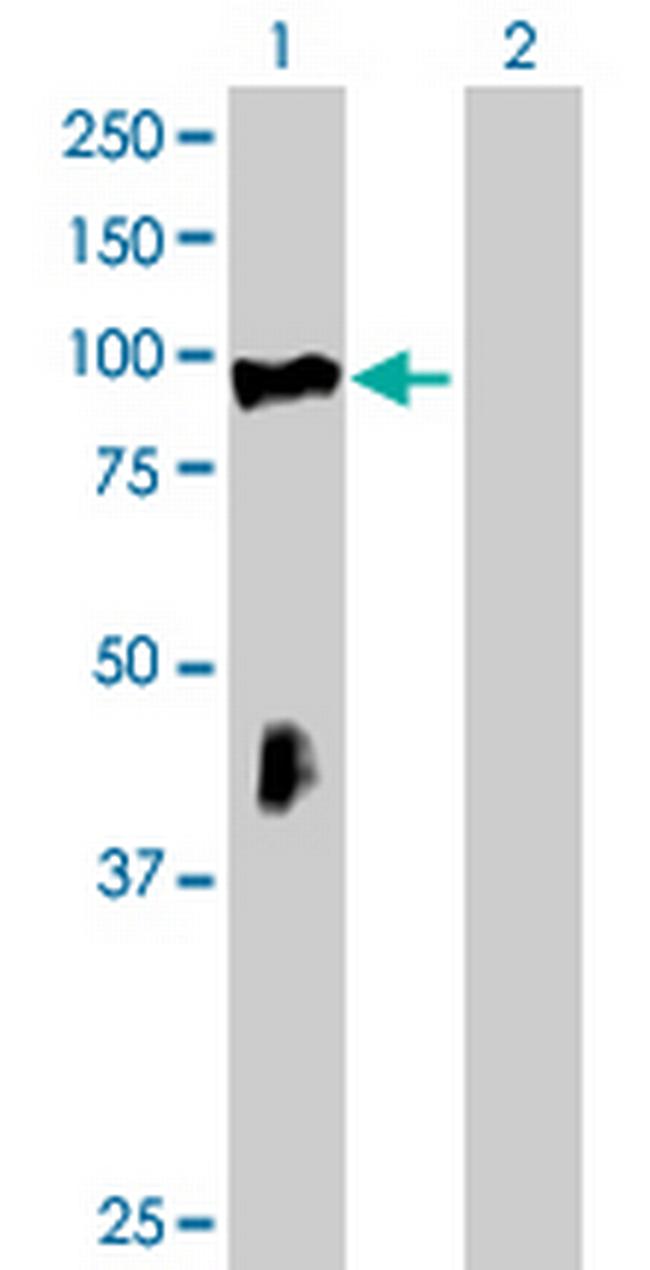 RHOBTB2 Antibody in Western Blot (WB)