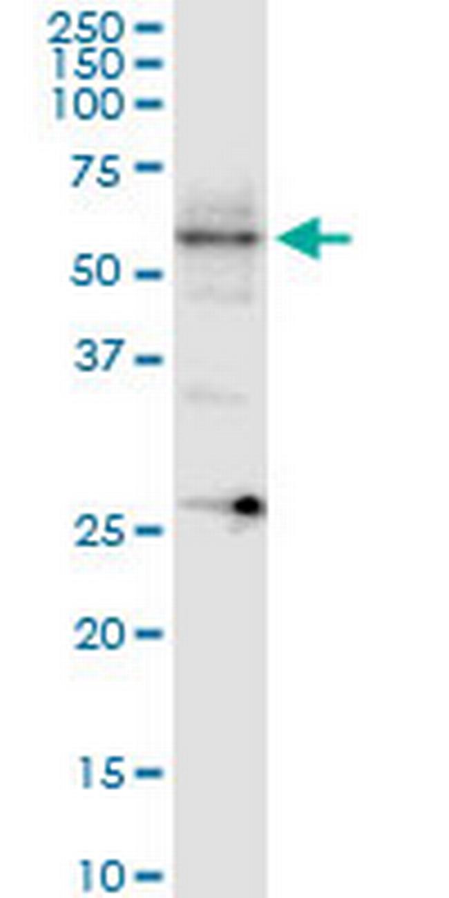 ARHGEF9 Antibody in Western Blot (WB)