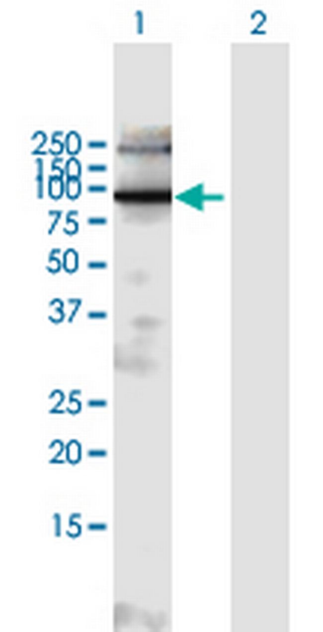 EXOC6B Antibody in Western Blot (WB)