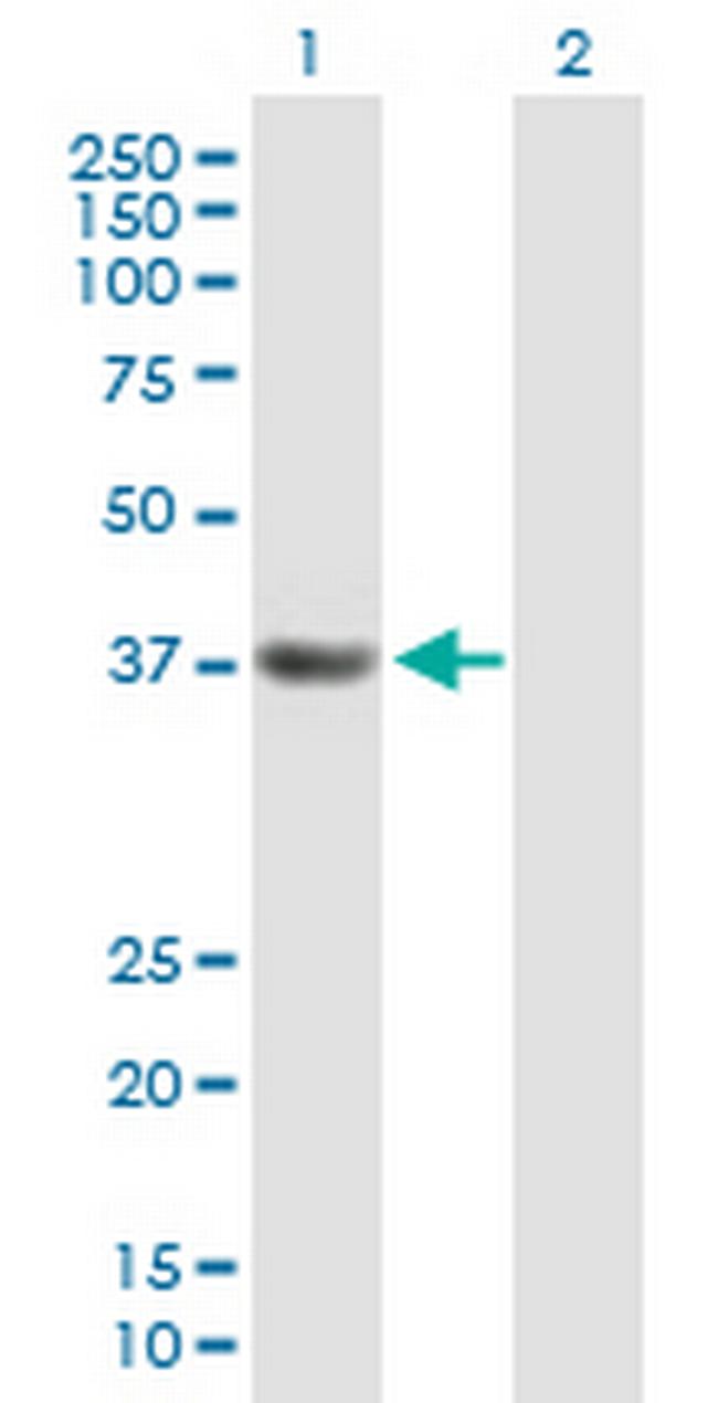 PDS5A Antibody in Western Blot (WB)