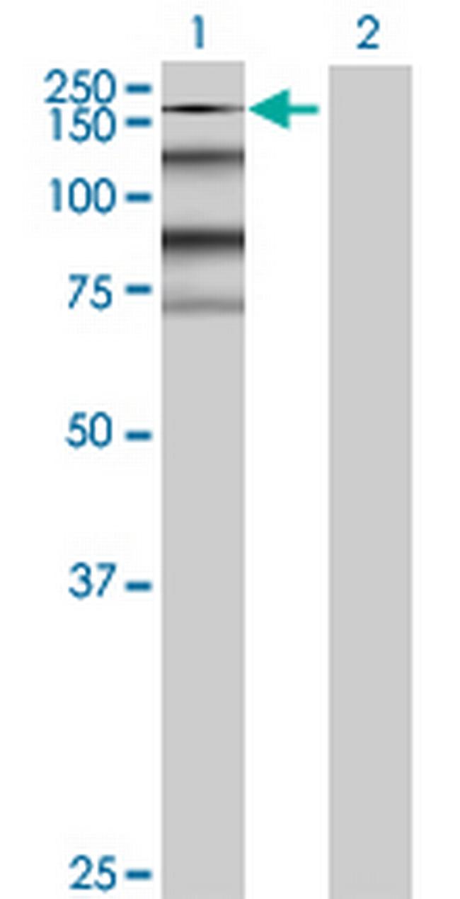 KIAA0460 Antibody in Western Blot (WB)