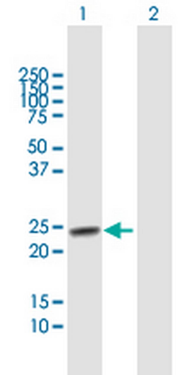 TSPYL4 Antibody in Western Blot (WB)
