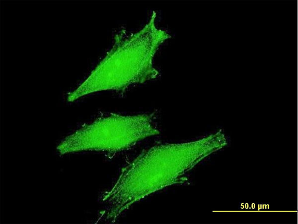 FBXW11 Antibody in Immunocytochemistry (ICC/IF)