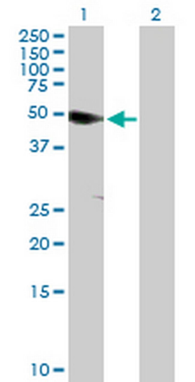 ANKS1A Antibody in Western Blot (WB)