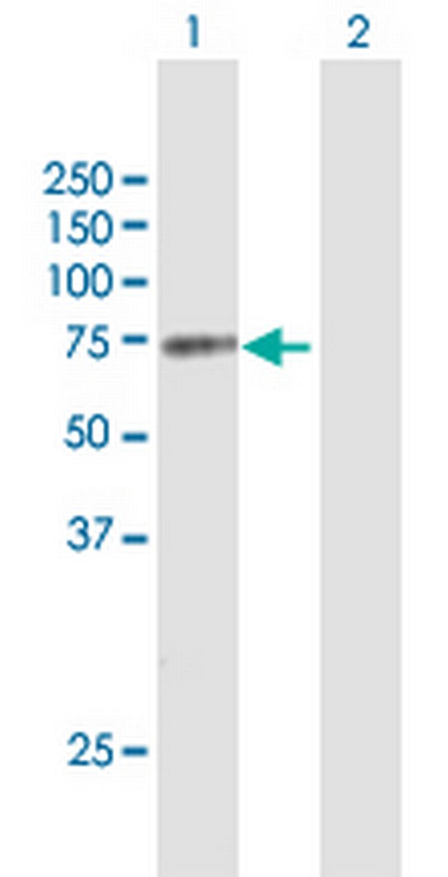 MGRN1 Antibody in Western Blot (WB)