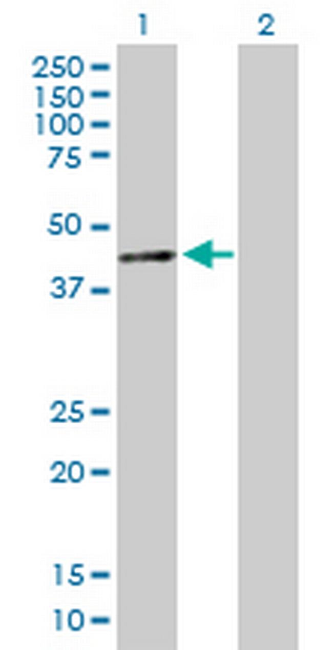SIN3B Antibody in Western Blot (WB)