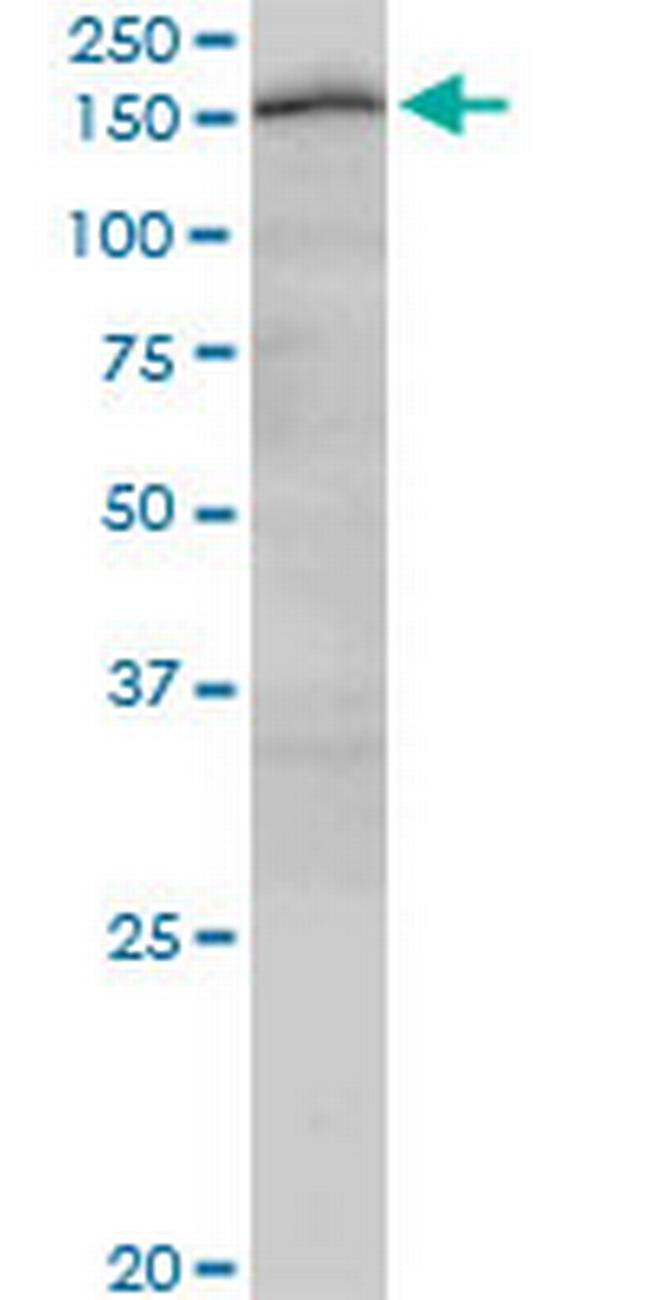 CUX2 Antibody in Western Blot (WB)