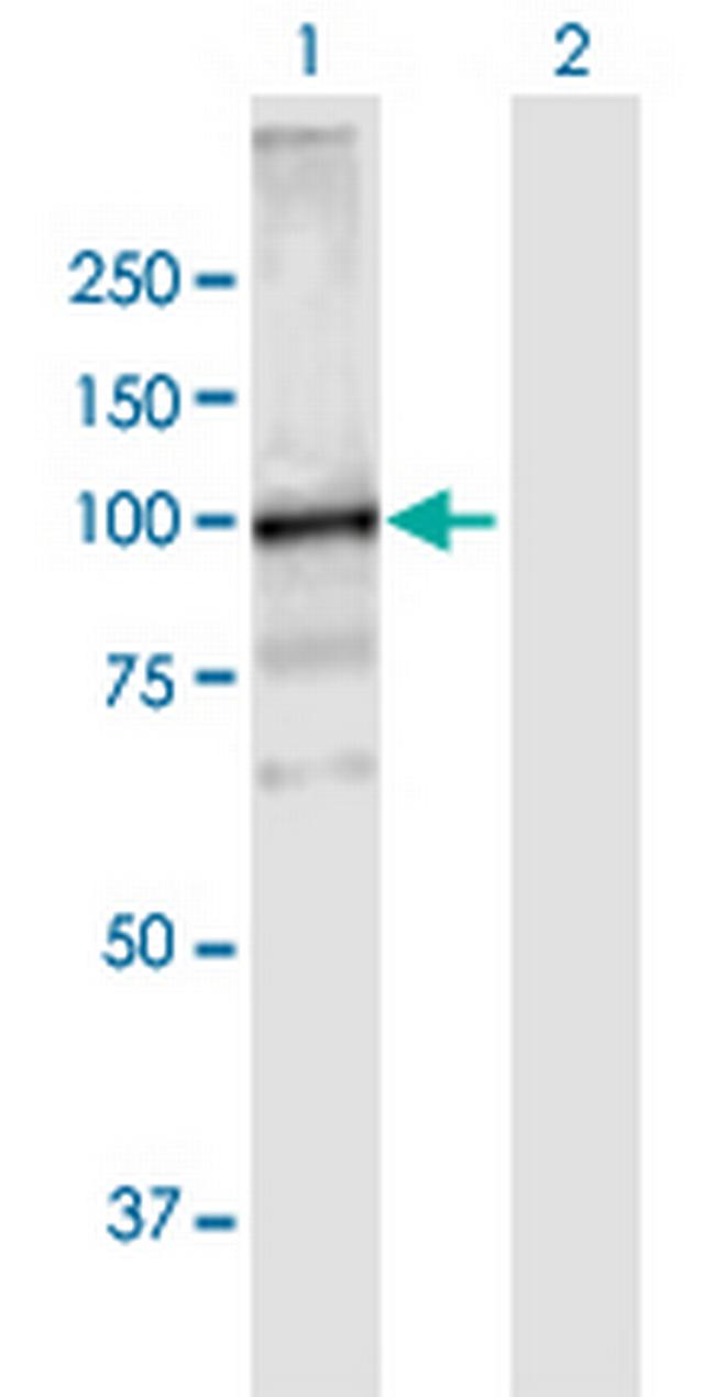 VPS39 Antibody in Western Blot (WB)