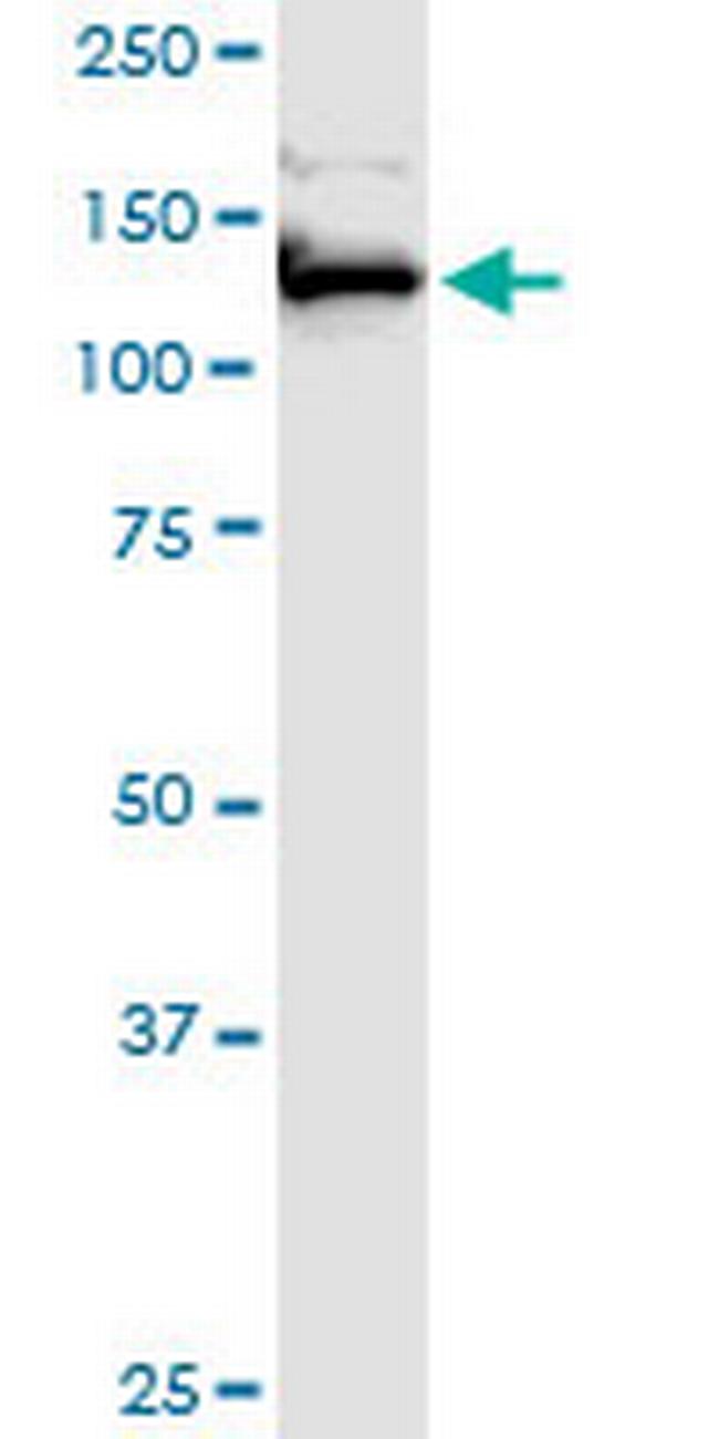 FAM62A Antibody in Western Blot (WB)