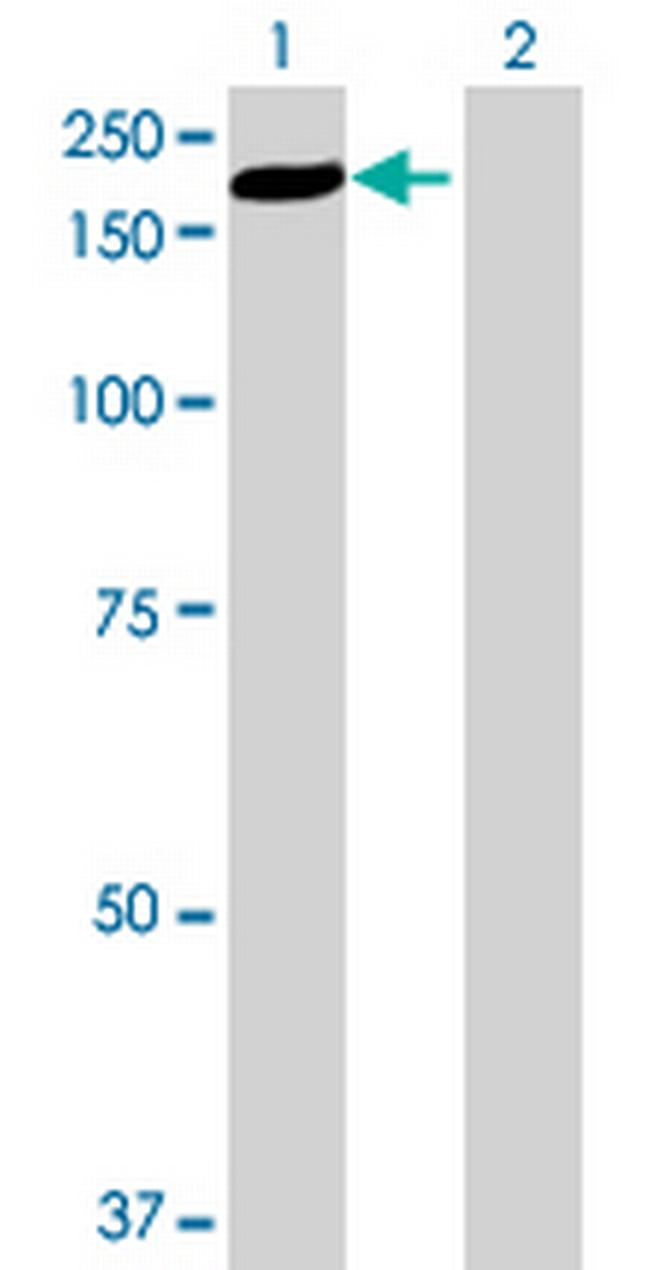 EST1B Antibody in Western Blot (WB)