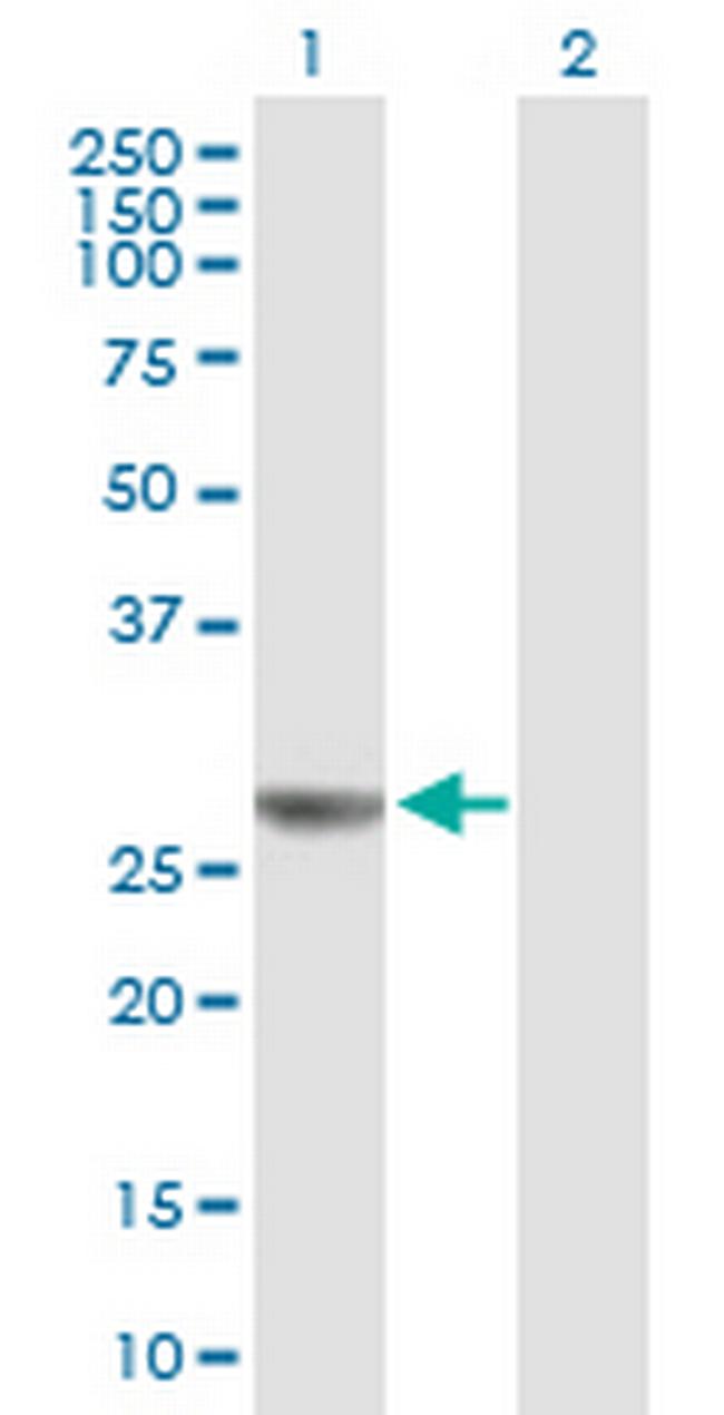 NUDCD3 Antibody in Western Blot (WB)
