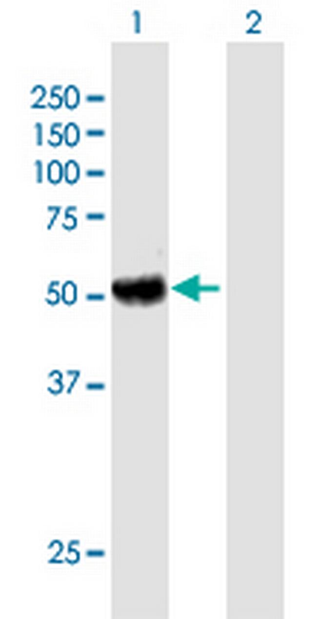 KIAA0368 Antibody in Western Blot (WB)