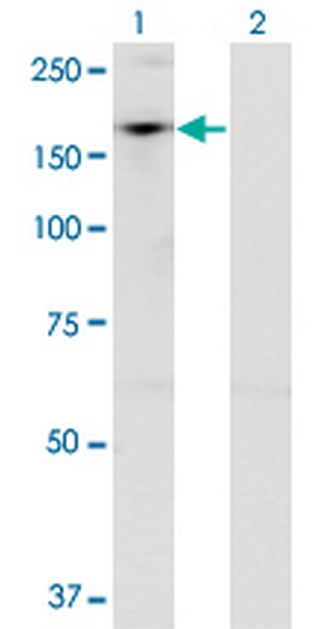 ADNP Antibody in Western Blot (WB)