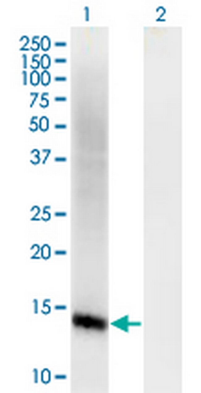 COTL1 Antibody in Western Blot (WB)