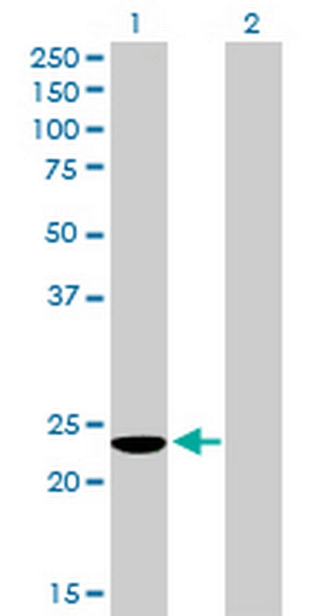 COMMD3 Antibody in Western Blot (WB)
