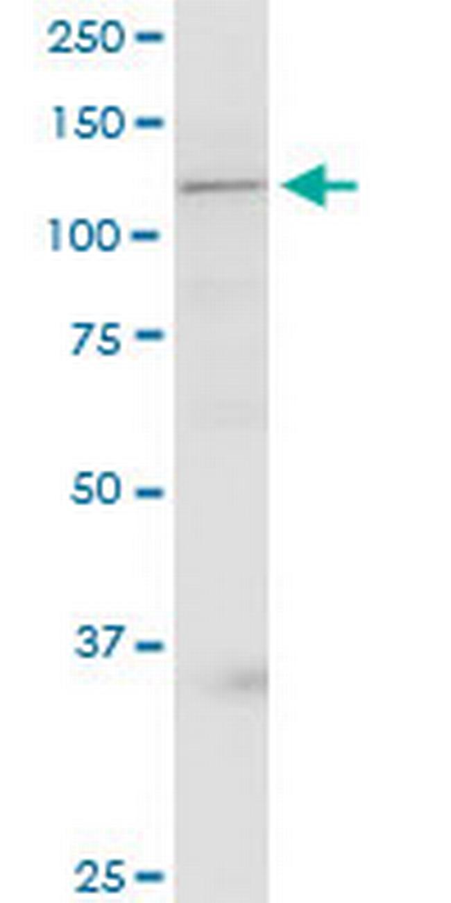 GRIP1 Antibody in Western Blot (WB)