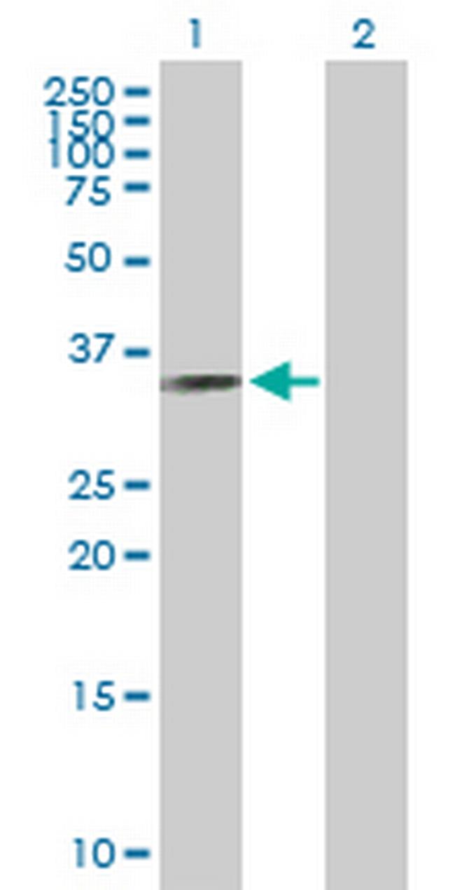RYBP Antibody in Western Blot (WB)