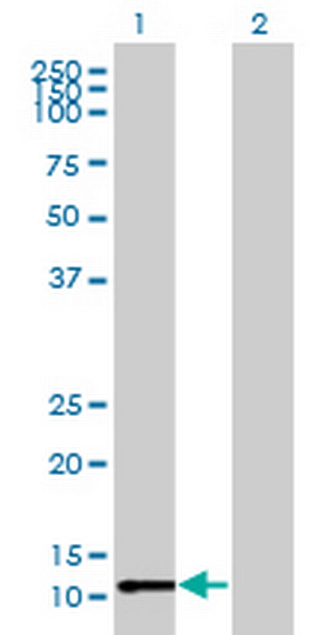 C3orf27 Antibody in Western Blot (WB)