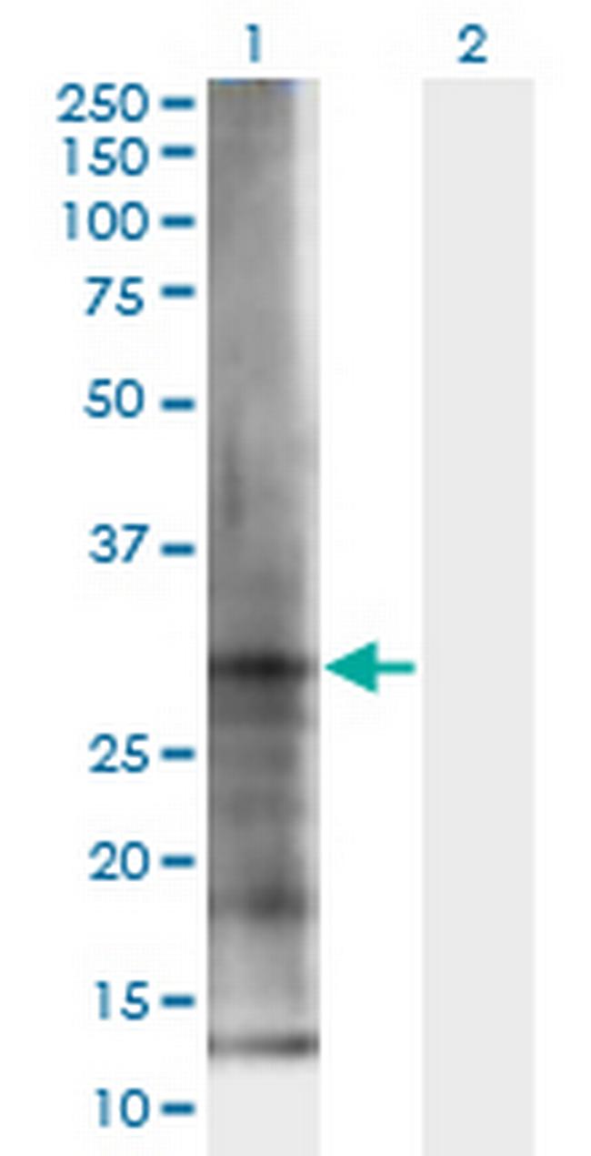 ELA3B Antibody in Western Blot (WB)