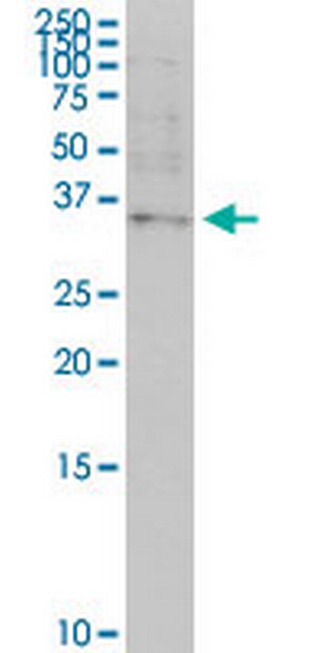 OTP Antibody in Western Blot (WB)