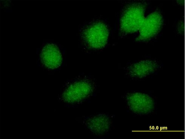 CBX6 Antibody in Immunocytochemistry (ICC/IF)