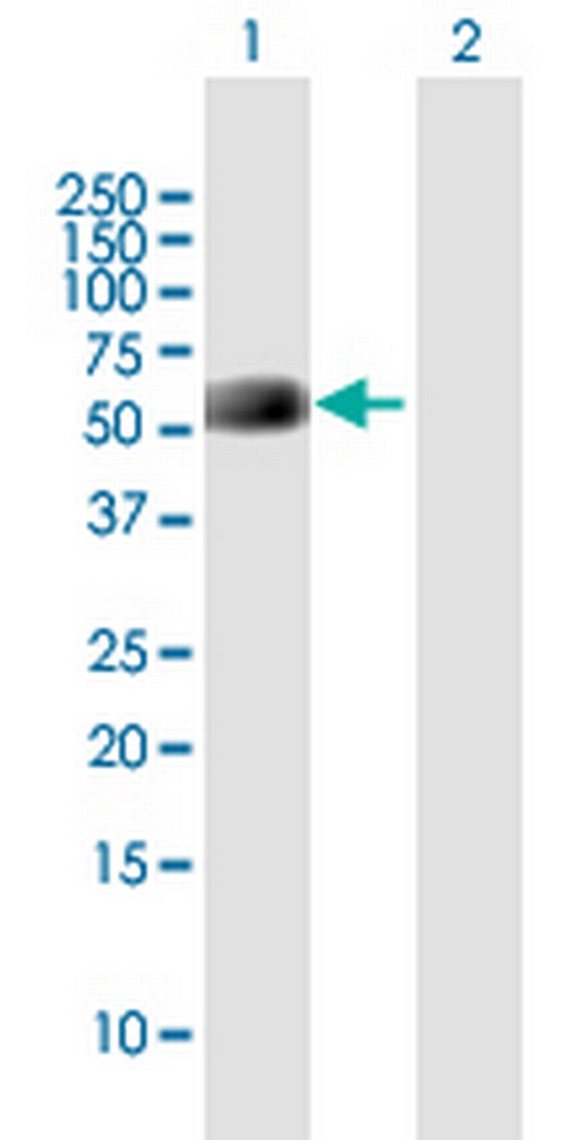 NPTXR Antibody in Western Blot (WB)