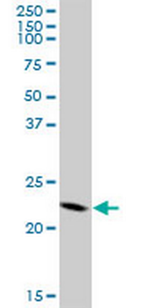 CBX5 Antibody in Western Blot (WB)