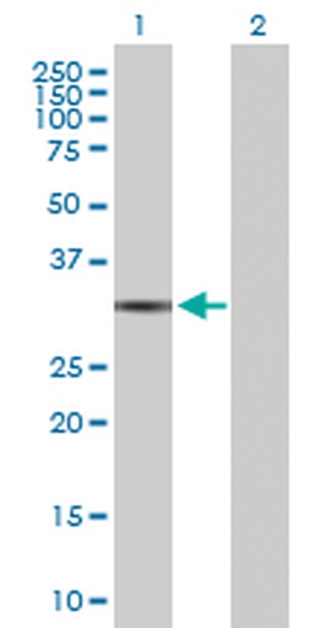 QPRT Antibody in Western Blot (WB)