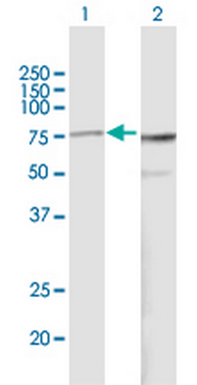 PES1 Antibody in Western Blot (WB)