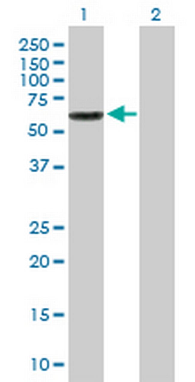 CES3 Antibody in Western Blot (WB)